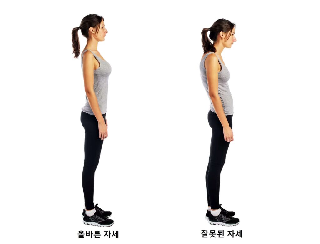 서있는 자세의 올바른 예, 잘못된 예 사진
